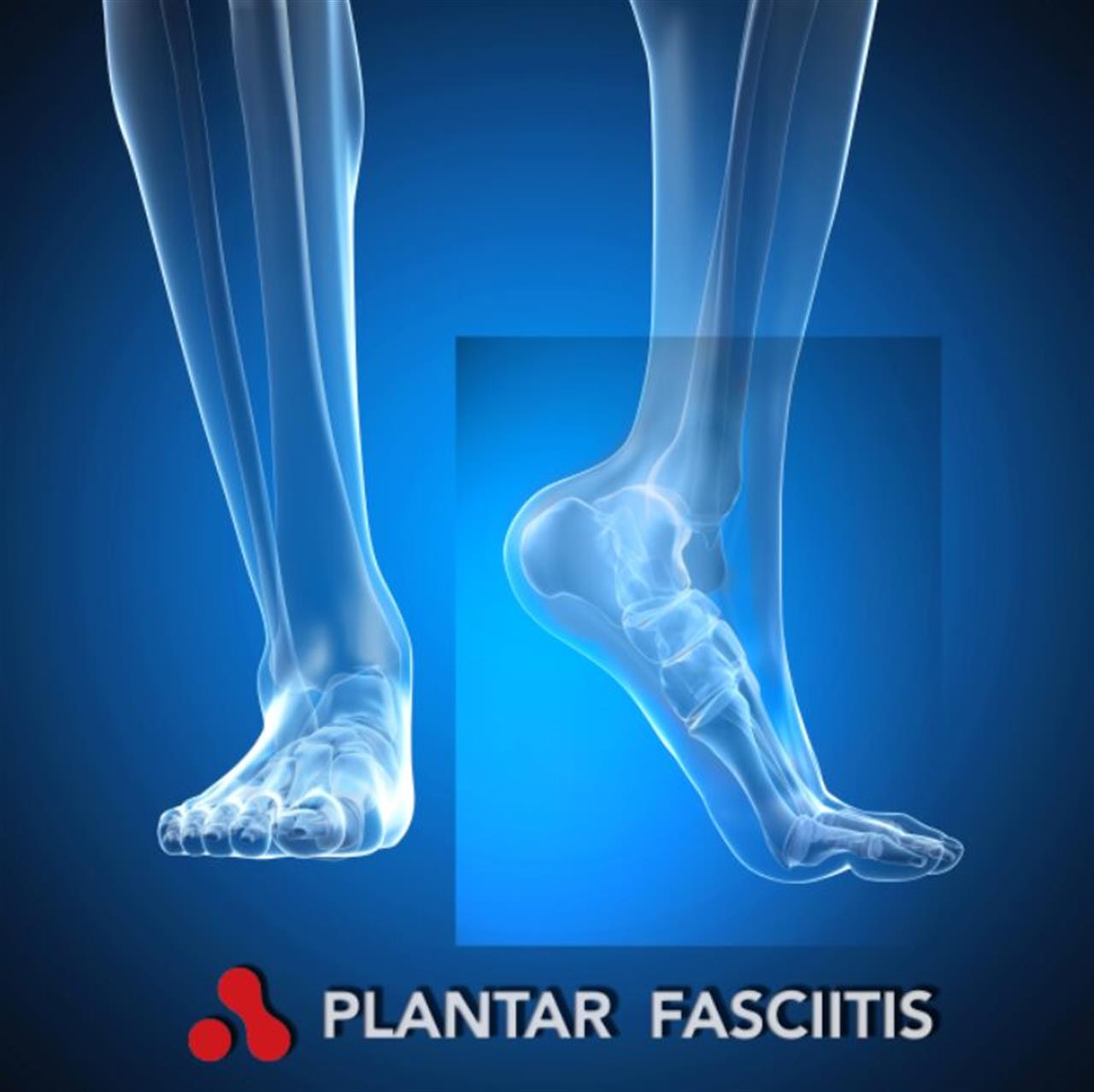 Guide til valg af indlægssåler find den perfekte støtte til dine fødder